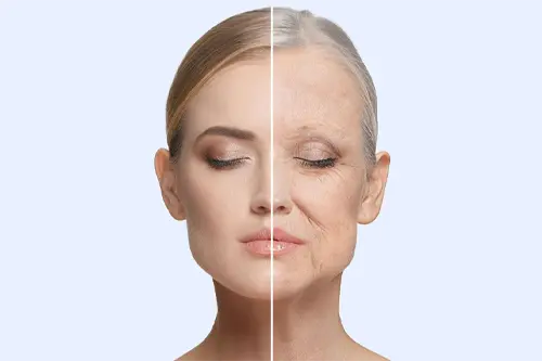 نتایج هایفوتراپی